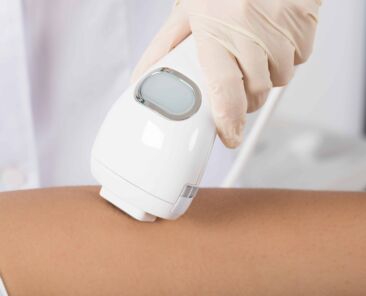 intense_pulsed_light