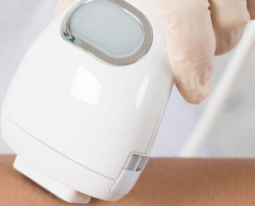 laser hair removal in Guelph