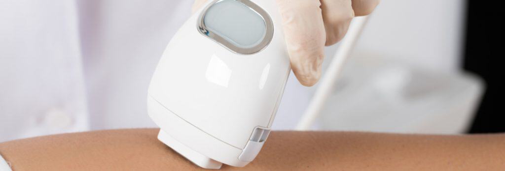 laser hair removal in Guelph